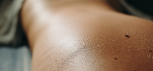 Антицеллюлитный массаж